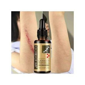 Lavender Burn Scar Tattoo Tribal Mark Cesarean Serum
