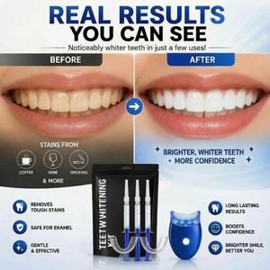 Beautiful Teeth Whitenin Kit White Teeth Whitener Dental Tooth Cleaner Whitener