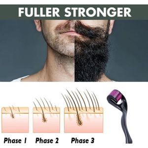 Genetic Derma Roller - Titanium Microneedle Skin Care Tool