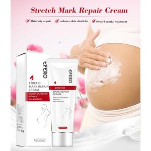 Efero Stretch Mark Renewal Cream (with Visible Result)