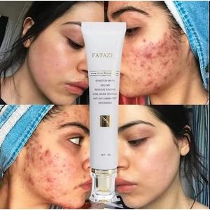FATAZEN Scar removal Cream for Acne Scars, Stretchmarks, CS scars, Keloids, Cuts and Surgery – Powerful Skin Repair Formula for Pregnancy Marks, Acne Scars, Blemishes, and Damaged Skin Treatment