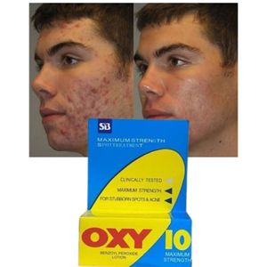 Oxy 10 Benzoyl Peroxide Lotion For Spot & Acne Treatment