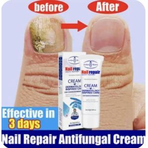 Aichun Beauty NAIL REPAIR CREAM