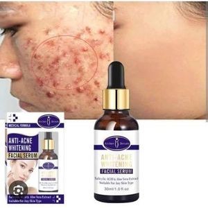 Aichun Beauty Aichun-Beauty Medical Forumla Anti-Acne Facial Serum