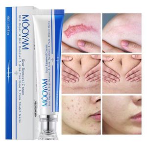 MOOYAM Scar Removal Cream, Acne Scar Cream, Repair Scar Cream Gel for Acne, Surgery, Injury, Burns, Suitable for All Skin Types