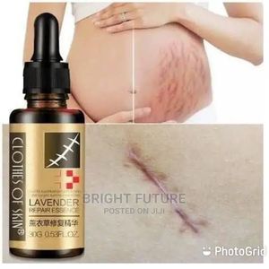 Stretch Mark Cream Available Best Price Online Jumia Nigeria
