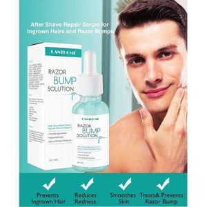 Razor Bump Solution Prevent Ingrown Hair Mild Moisturizing Shave Repair, Treats Razor Rash & Ingrown Hairs, Unisex, All Skin & Hair Types Fights Ingrowns, Bumps, Acne, Blemishes & Filaments, After Shave Repair Serum