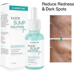 Lanthome Unisex Ingrown Hair Reduction Serum, Ingrown Hair Serum For Man and Women, Gentle to Redness And Razor Bump Stopper Solution Dark Spot Corrector After Shave Repair Serum For Ingrown Hair, After Shave for Ingrowns and Burns, Dark Spot Corrector