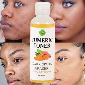 MOOYAM Tumeric Toner Dark Spots Eraser