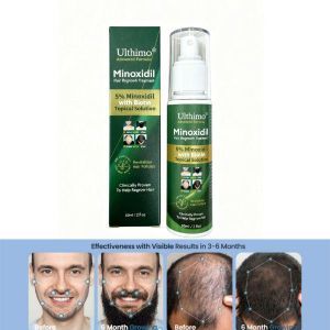 Ultimo Complete 5% minoxidil Extra Strength, Hair & Beard Growth Treatment with Biotin tropical solution