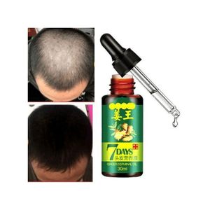 7 Days Ginger Hair Growth Oil 30ML