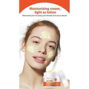 MOOYAM Advanced Acne Face Cream For Acne Cream Pimple For Face, Spot Face And Body, Spotfor Oily Prone Skin, Dark Spot & Scar Removal, Blackhead Acne Spot Treatment Remover Cream