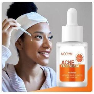 MOOYAM ACNE FACE REMOVAL SERUM KOREAN WHITENIN MOISTURIZING SHRINK PORES OIL CONTROL Serum