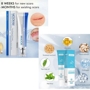 MOOYAM Scar Removal cream & 12hr salicylic acid remove acne cream