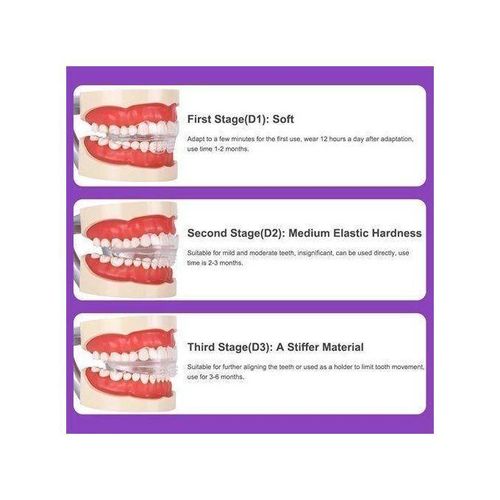 Generic 3-Stage Teeth Aligner Brace – Invisible Orthodontic Trainer for Teeth Straightening & Correction - image 7
