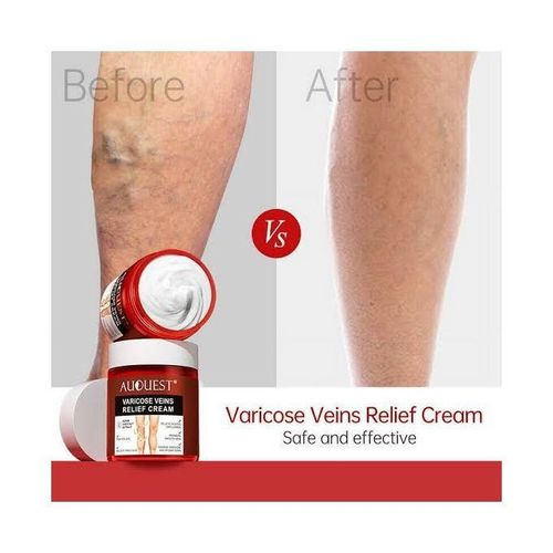 product_image_name-Auquest-Varicose Veins Relief Cream 80g-1