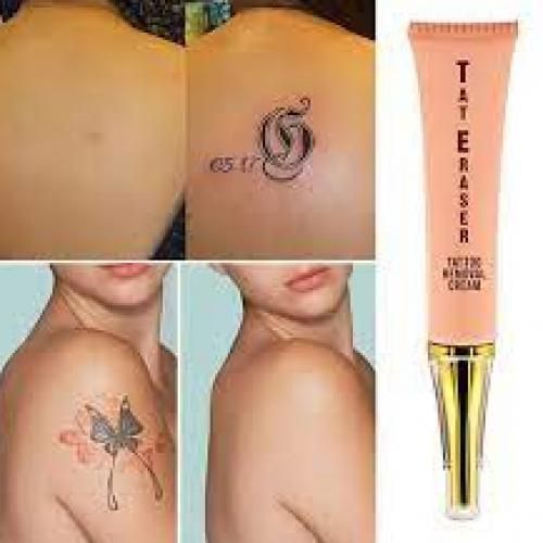 Does Tattoo Removal Cream Work? - tattooglee | Tattoo removal cream, Tattoo  cream, Tattoo removal