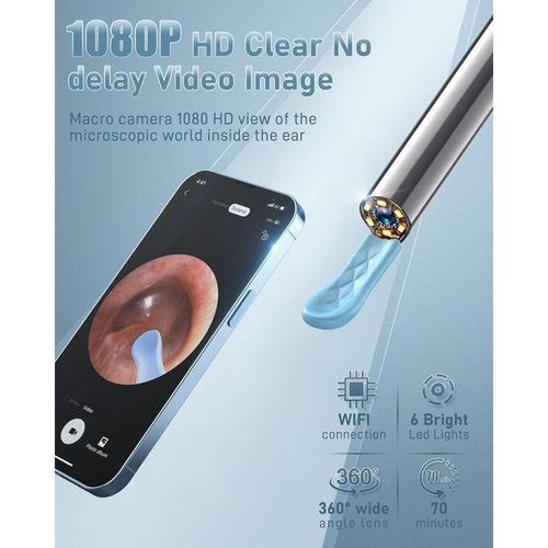 product_image_name-Generic-Ear Wax Removal Tool Camera - Ear Wax Removal Kit - Ear Cleaner with Camera - 1080P HD Ear Camera with 6 Ear Spoon - Ear Cleaner for iOS & Android-2