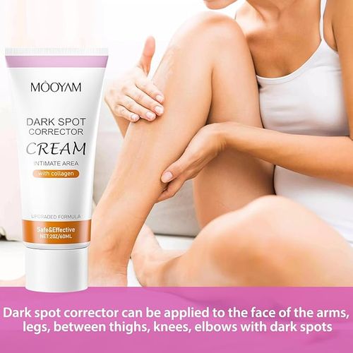 MOOYAM Effective Dark Spot Removal Cream Skin Moisturizer For Skin Jumia Nigeria