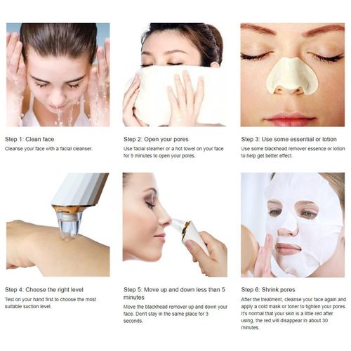 product_image_name-Generic-Rechargeable Dermasuction Blackhead Remover Device +interchangeable 4 Sunction heads -4