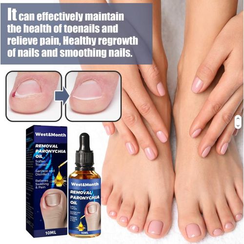 product_image_name-West&Month-Ingrown Toenail Treatment, Toe Nail Softener,Supports Nail Growth, Easy Nail Trimming Formula, Gentle on Nails – Fungal Nail Treatment, Toenail Fungus Treatment, Nail Strengthener for Weak Nails, Ingrowth Toenail Correction Treatment Oil-1