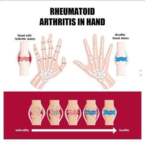 product_image_name-Perfectx-50g FAST AND EFFECTIVE SOLUTION FOR BONE AND JOINT PAIN, Bone pain cream, Joint pain cream, Quick Joint pain Relief Cream, DEEP CONCENTRATE BONE and JOINT CREAM, Joint pain relief cream Intensive concentrate cream, Arthritis cream Natural joint cream-6