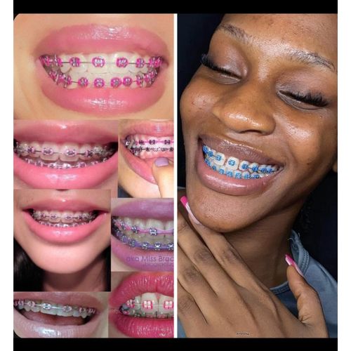 product_image_name-Fashion-Upgrade your smile in seconds, Unisex Removable teeth braces that give you that bold, confident look without commitment. Easy to wear. Easy to remove. Stand out effortlessly.-1