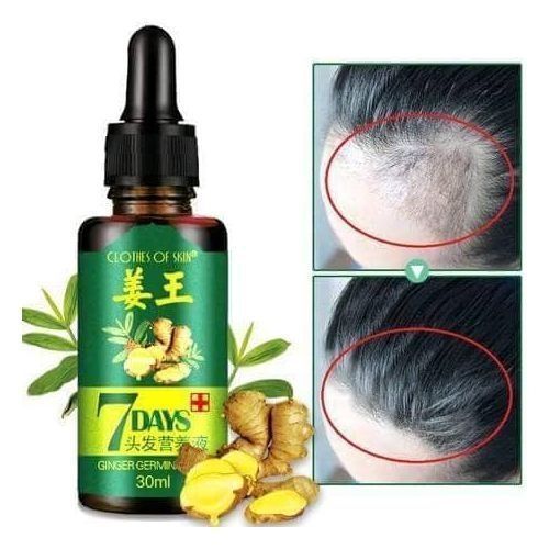 Clothes Of Skin 7 Days Ginger Germinal Hair Growth Oil Jumia Nigeria