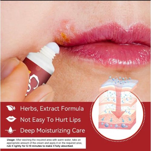 product_image_name-Sumifun- Cold Sores Cream -3