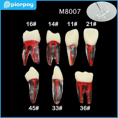 Generic Endo Training Root Canal Model Rotary Files Rct Endodontics ...