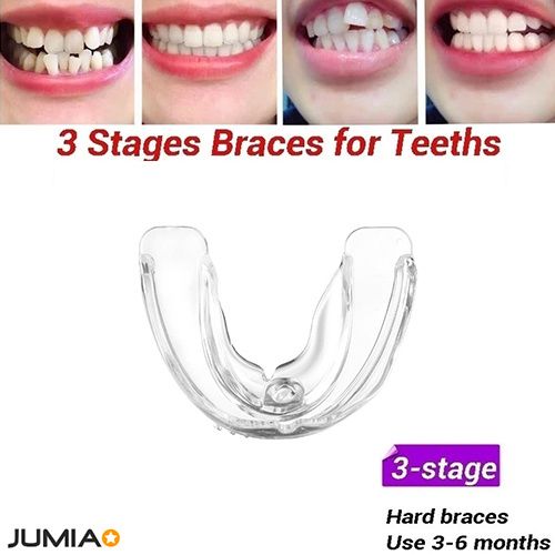 Generic 3 Stages Teeth Corrector Bend Brace Aligner-3 Stage | Jumia Nigeria