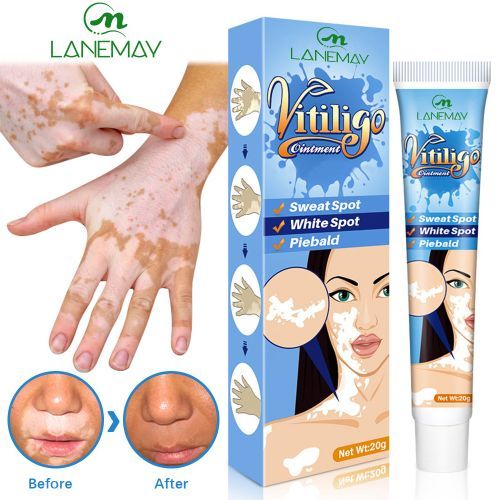 product_image_name-Generic-Herbal Extract Vitiligo Removal Onitiment Treatments-1