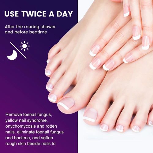product_image_name-Sumifun-Nail Fungus, Anti-bacterial, Cream For Foot And Fingernails Care-7