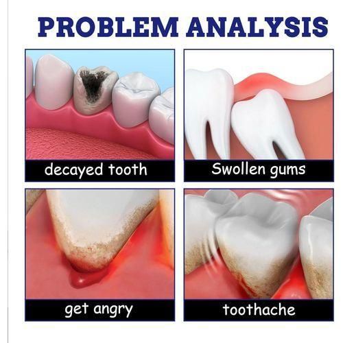 product_image_name-Generic-TOOTHACHE INSTANT PAIN RELIEF/REPAIR SPRAY-3