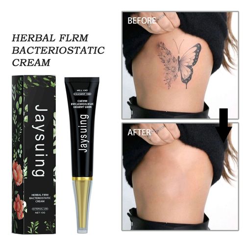 Permanent Tattoo Removal Cream,Scar Removal Cream Nepal | Ubuy