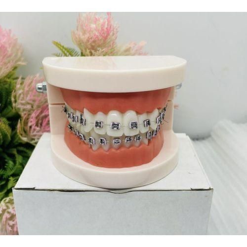 product_image_name-Generic-Miami Unisex Teeth Braces _Fashion/Dental Care Tool -2