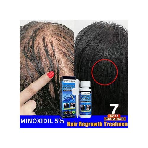 product_image_name-Minoxidil-East Moon 5% Hair & Beard Growth Hair Increase Oil - Hair Treatment-4