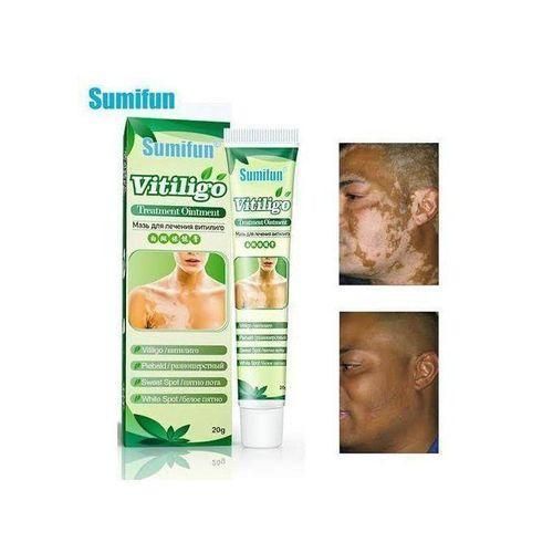 product_image_name-Sumifun-Original Vitiligo cream-2