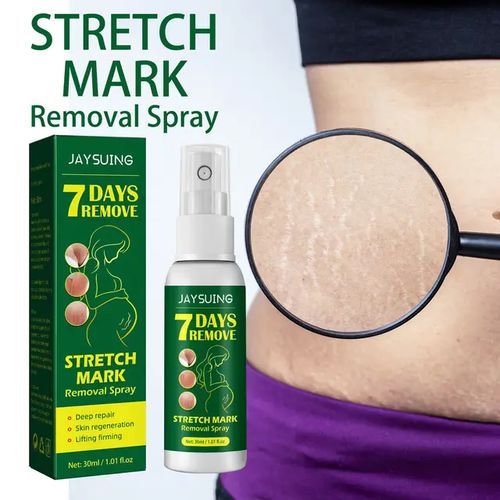 product_image_name-JAYSUING-7 Days Super Strong Stretch Mark Removal Spray-5