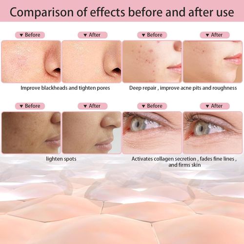 product_image_name-Generic-Wireless 7 Colors Photon Face Neck Beauty LED Mask Facial SPA Mask Red Light Skin Repair Skin Care Anti-Ance Tighten Anti-A-ging-5