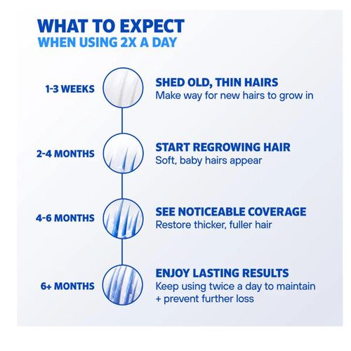 product_image_name-Rogaine-Men's 5% Minoxidil Foam For Hair Regrowth - 1 Month Sup -3