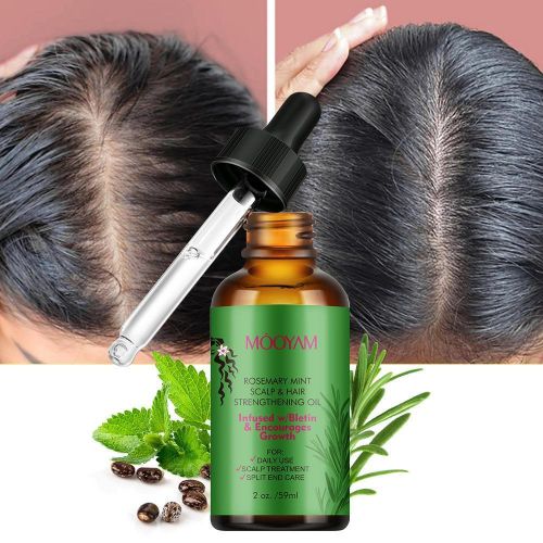 product_image_name-Generic-Mooyam Rosemary Hair Strengthening Oil 60ml-3