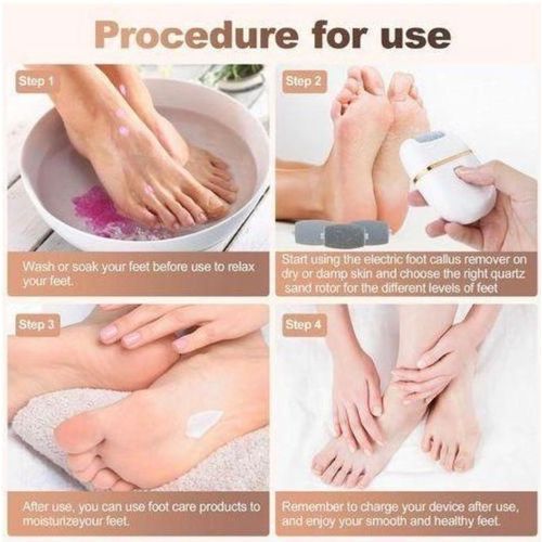 Generic Electric Foot File Callus Remover, Rechargeable Pedicure Tool with Powerful Motor White - image 6