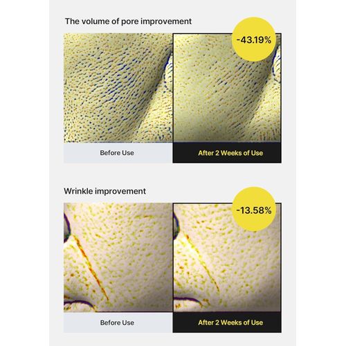 product_image_name-celimax-The Vita-A Retinol Shot Tightening Serum 30ml-5