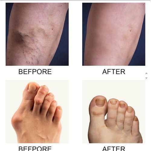 product_image_name-Perfectx-50g PAIN RELEIF Cream for all types of Body and Bone Pain, Provides Relief Back, Neck, Hands, Feet Muscle Recovery Relief for Back, Neck, Hands, Feet-3