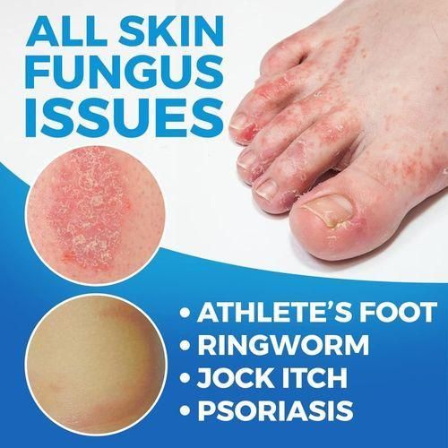 Imperial Athlete's Foot Solution 75ml - image 2