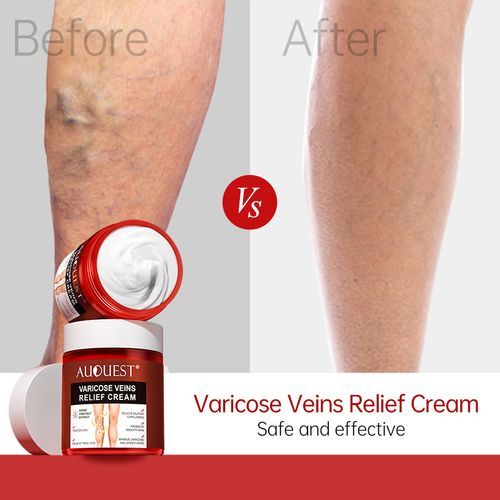 product_image_name-Generic-Varicose Veins Relief Cream-1