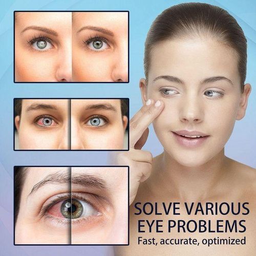 product_image_name-Generic- Eye drops Relieve Eye Fatigue, Dryness and Blurriness, Daily Gentle Moisturizing Eye Care Solution - Moisturizing and Clear Eye Care Solution-2