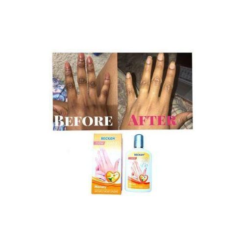 product_image_name-Generic-Original Dark Knuckle Remover And Hand Moisturizer -1