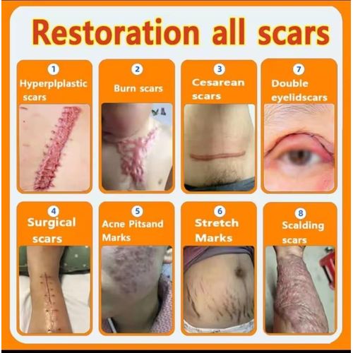 product_image_name-Chin-Recovery scars cream, surgery scar, fast removal of skin keloids and scars, stretch mark and anti pigmentation-3